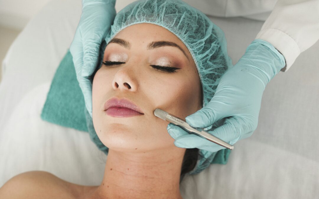 Discover Youthful Skin with Microneedling and Radiofrequency