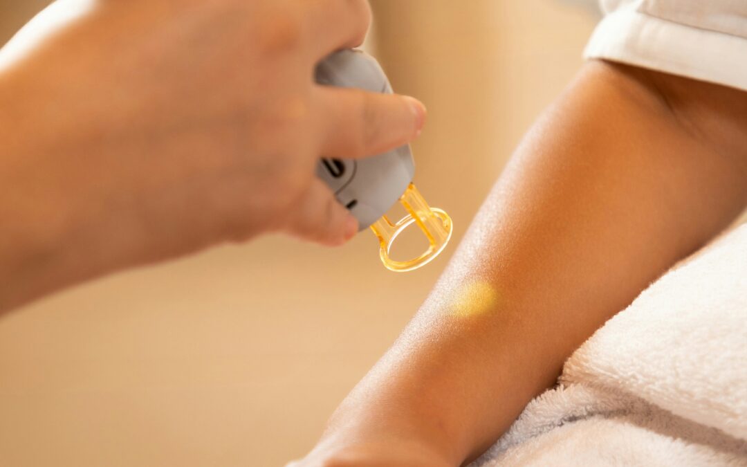 Why Laser Hair Removal is the Ultimate Long-Term Solution