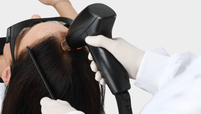 The Best Hair Restoration Clinics in Metro Detroit